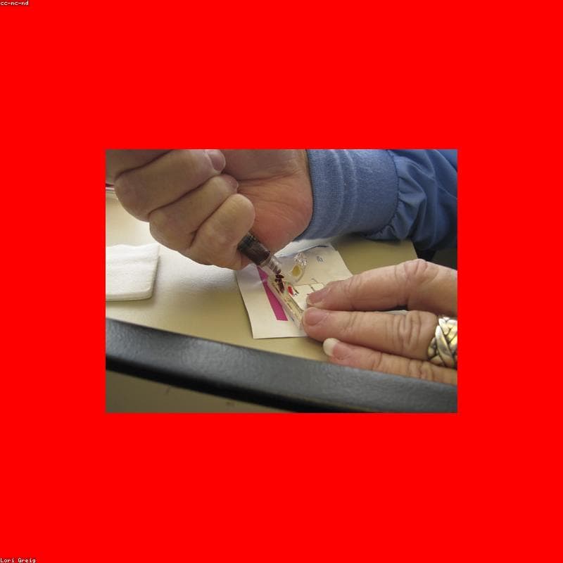 Eco-Friendly Diagnostic Test Kits - Ready to Ship